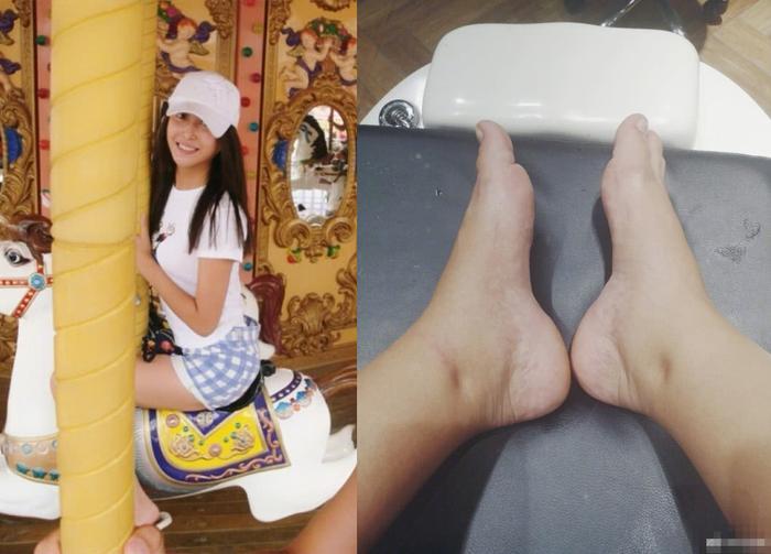 严屹宽晒杜若溪孕肚照，脸色蜡黄水肿严重，网友：是真爱无疑了！