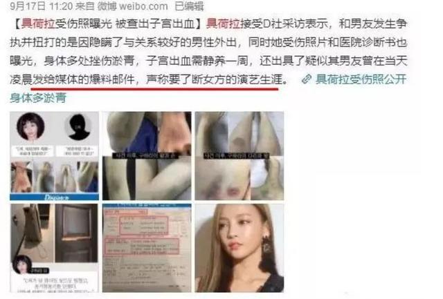 Anglebaby被爆出轨成性？遭黄晓明暴打？