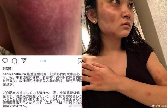 Anglebaby被爆出轨成性？遭黄晓明暴打？