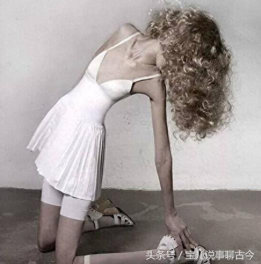她是世界上最瘦女孩 体重只有22斤 还在坚持做减肥操！你羡慕么？