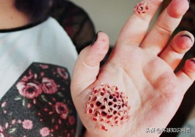人为什么会有密集物体恐惧症（十种最奇异的恐惧症）(10)