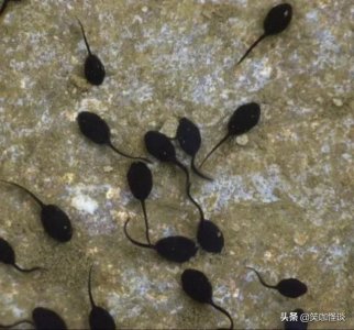 ​小时候都抓过蝌蚪吧，那么蟾蜍和青蛙什么区分呢？