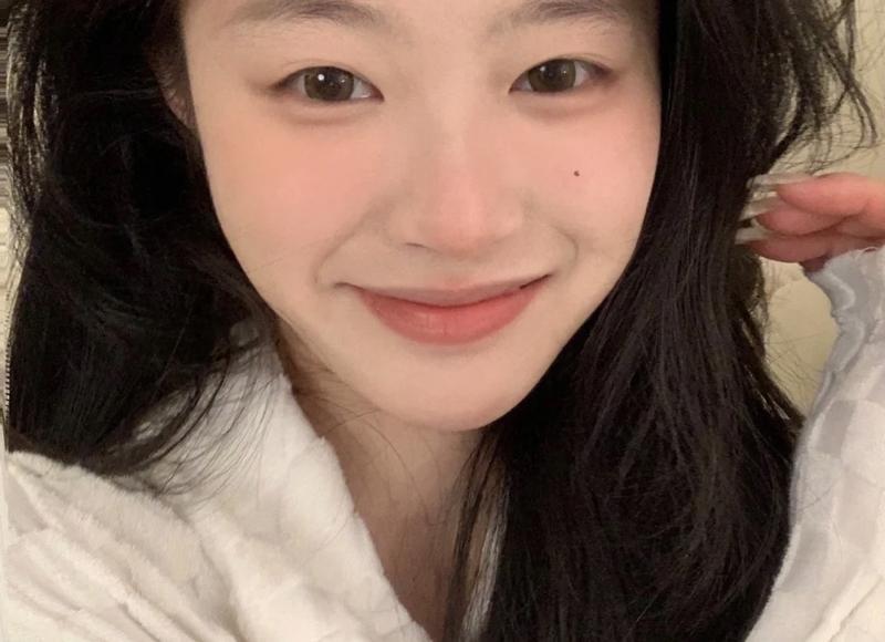 视网膜黄斑区对视觉功能重要。 视网膜黄斑区对视觉功能重要。